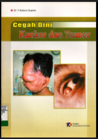 Image of Cegah Dini Kanker dan Tumor